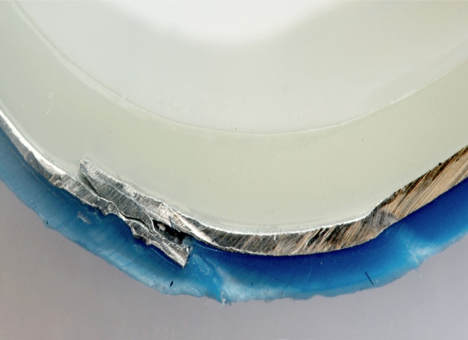 My teeth are crooked. I had braces for 4 years, 2014, archival print mounted on aluminium, modified detail from ΔΝ22 (2011) 34 x 24,7 cm